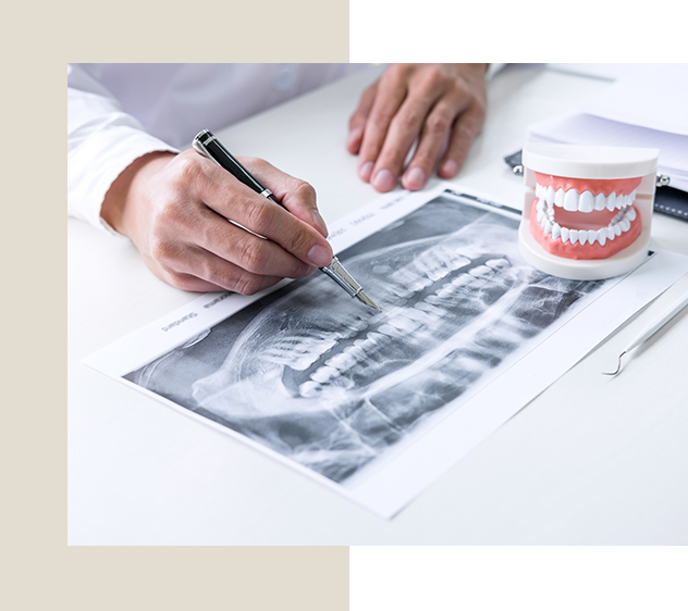 歯の神経を「守る」歯髄温存療法と歯を「残す」ための根管治療