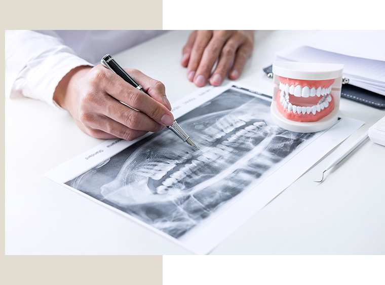 歯の神経を「守る」歯髄温存療法と歯を「残す」ための根管治療
